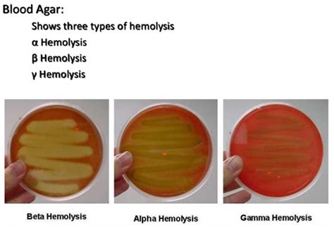 Hemolysis (microbiology) .